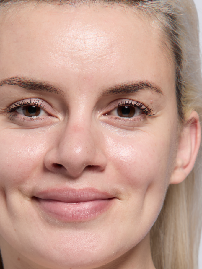 Light skin tone model shown before applying foundation.